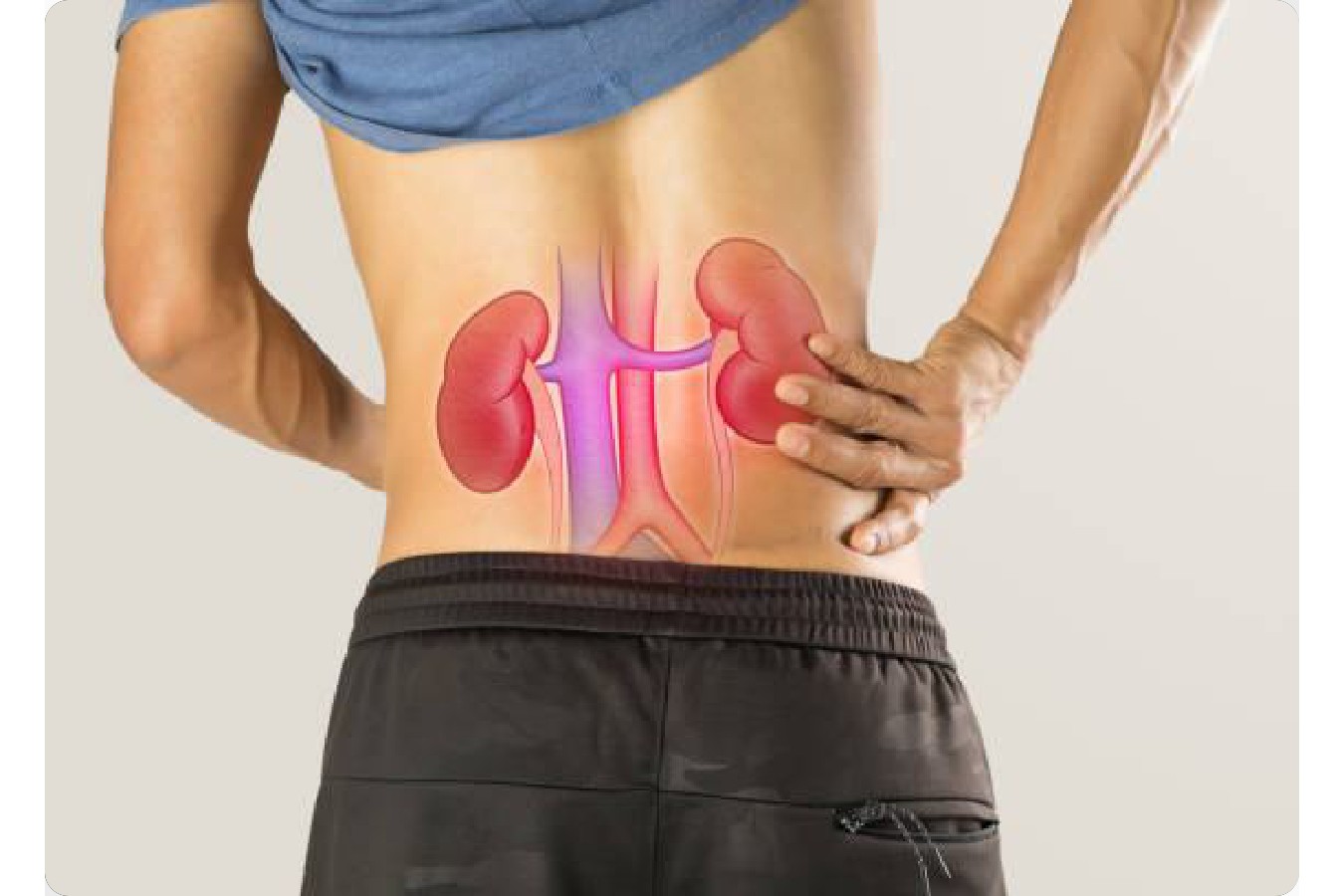Cáncer de riñón